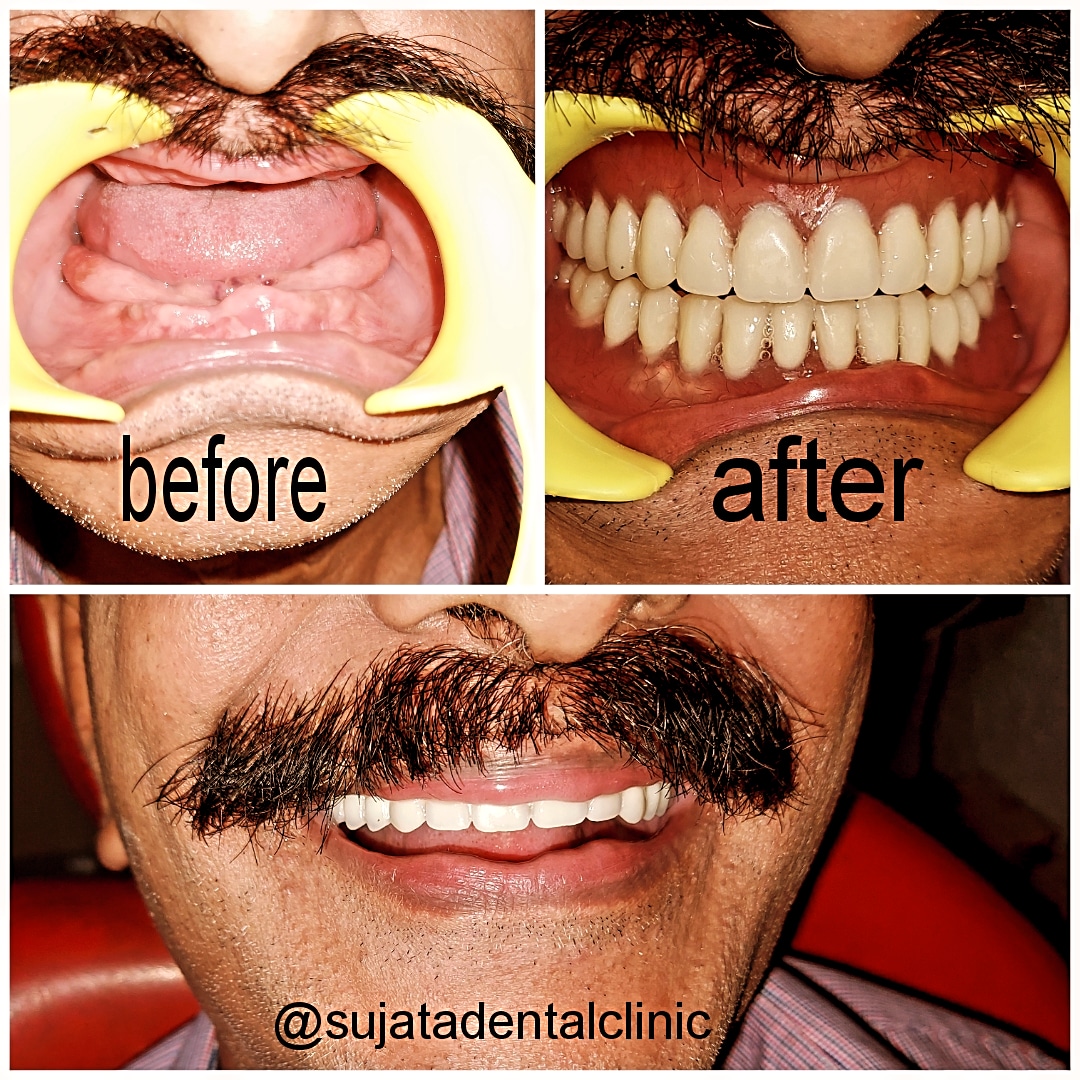 Smile transformation 9