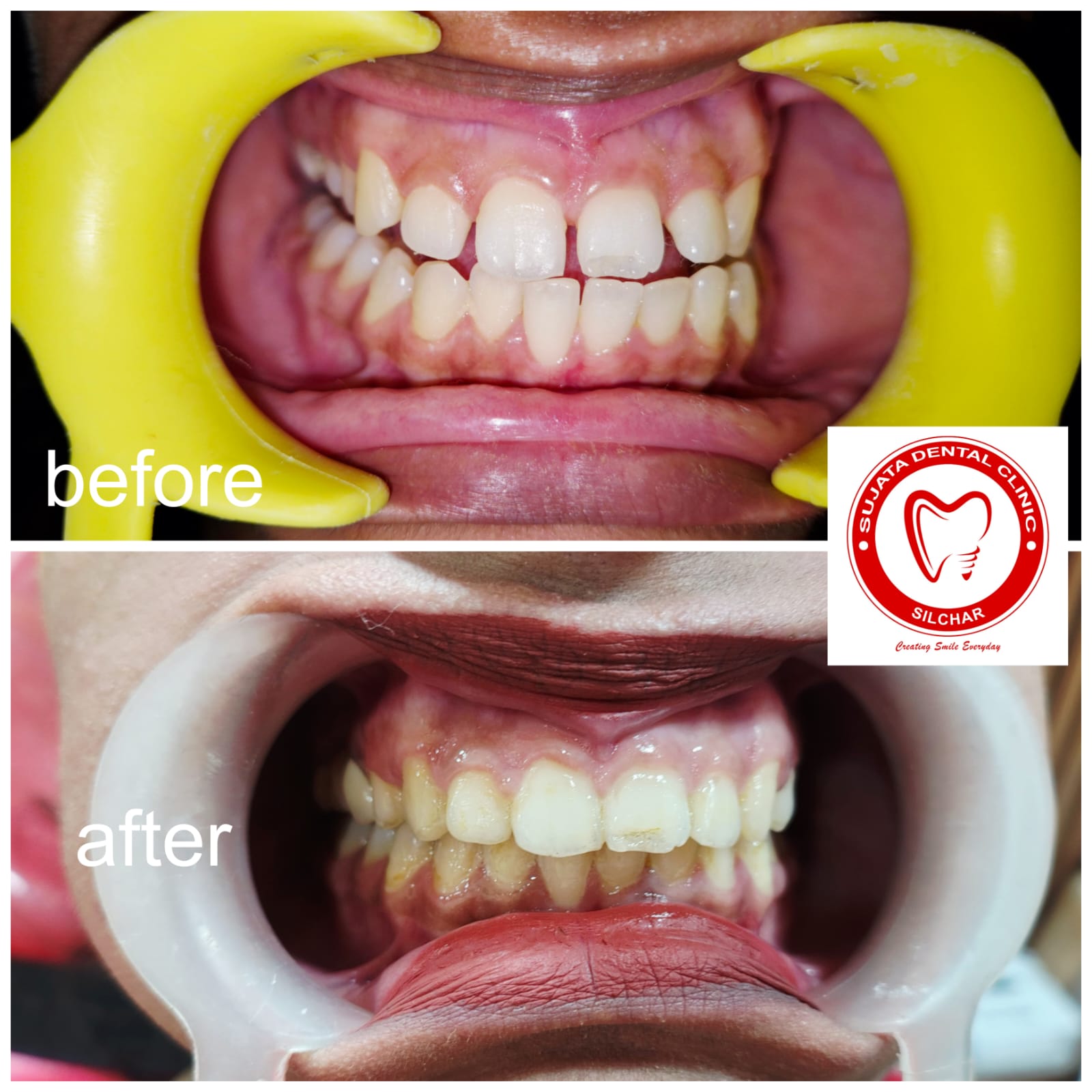 Smile transformation 7