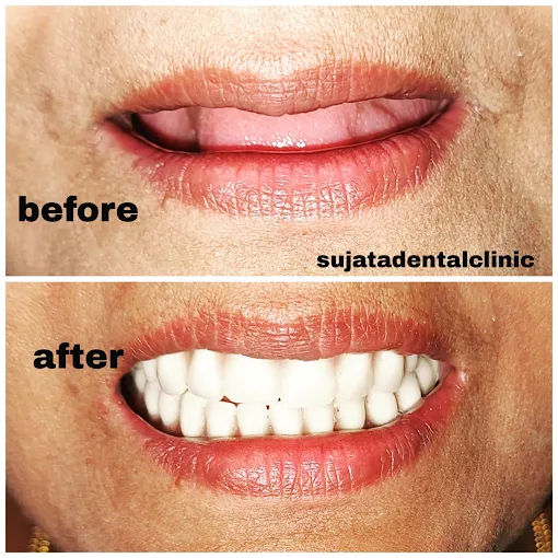 Smile transformation 1