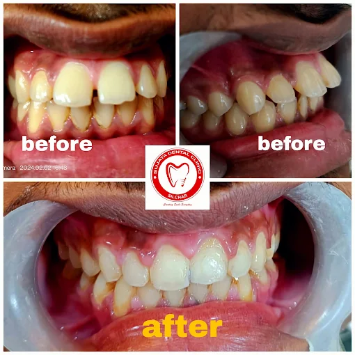 Smile transformation 3